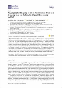 Angiographic Imaging of an In Vivo Mouse Brain as a Guiding Star for Automatic Digital Refocusing in OCT
